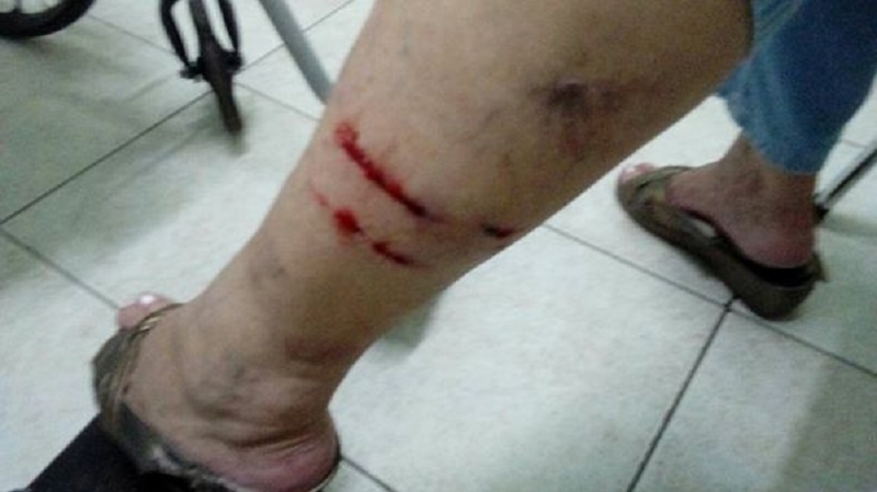 Senhora é atacada por cães na Vila Adileta