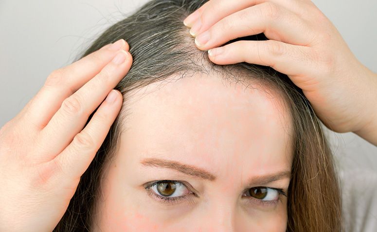 3 motivos pelos quais seu cabelo está ficando branco muito cedo