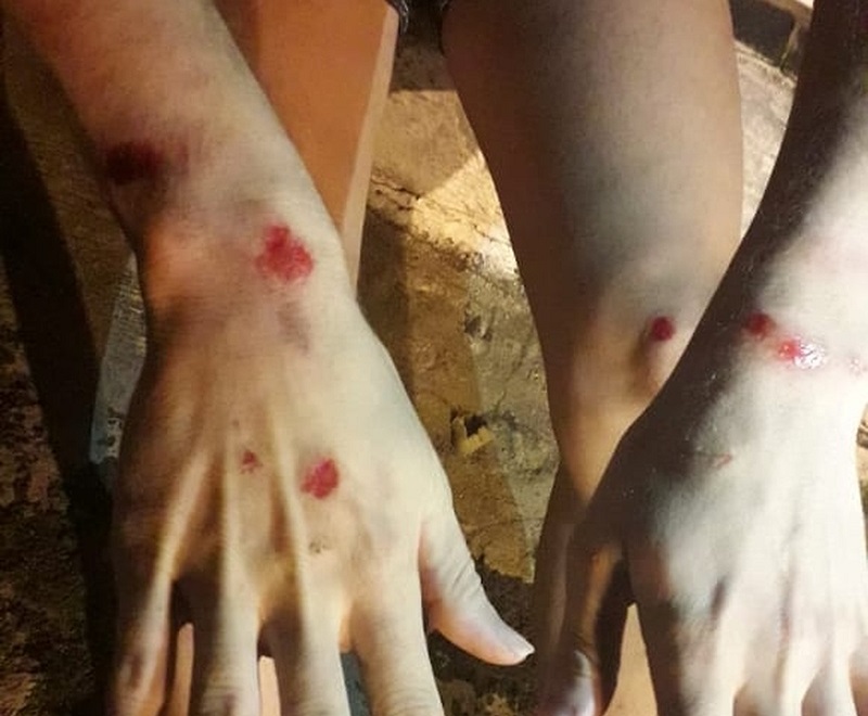 Jovem é agredido em Tupã e alega homofobia: ‘Disseram que ‘viado’ tinha que morrer’