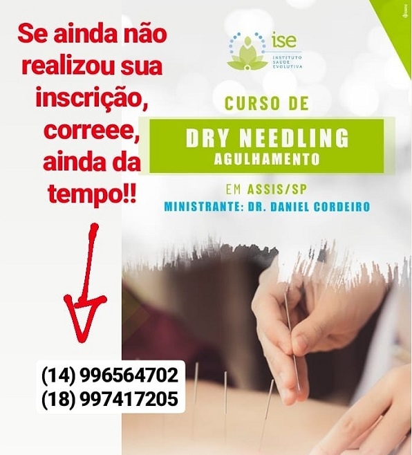 Assis terá dois dias de curso Dry Needling (Agulhamento a Seco)