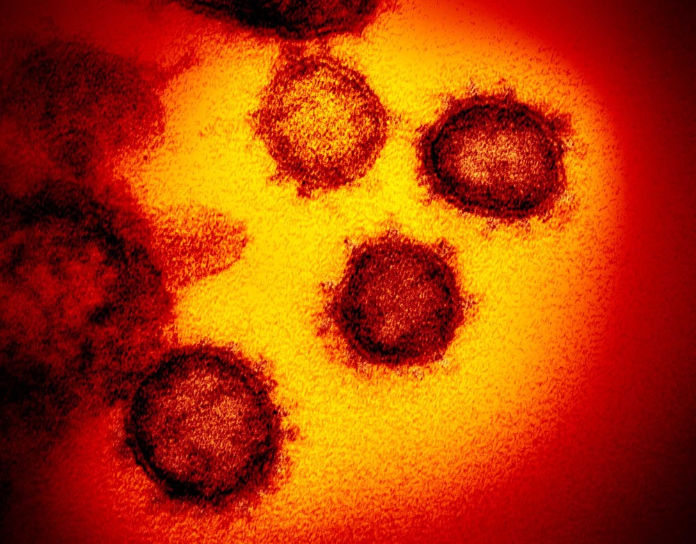 Coronavírus: Sobe para sete o número de suspeitos