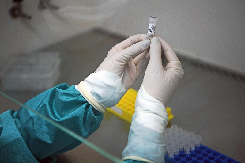 Coronavírus: Amostra do primeiro caso suspeito em Assis estava contaminada