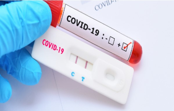 Alunos da Biotecnologia da Unesp desenvolve teste rápido para a Codiv-19, mas precisa de ajuda