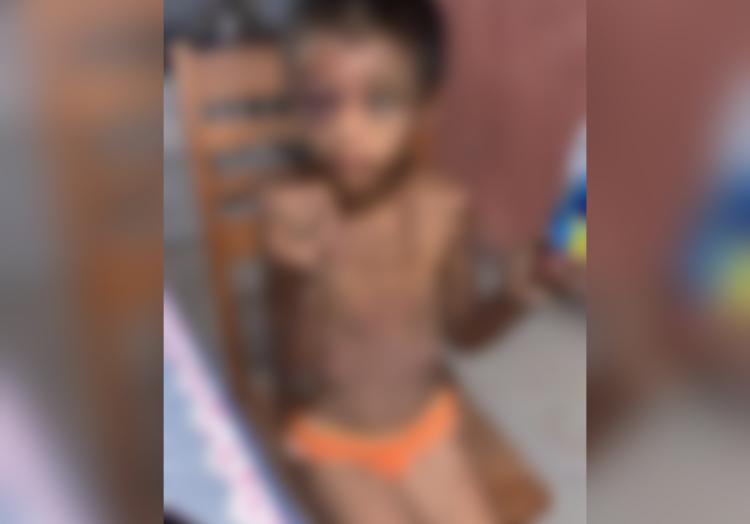 Menina de 9 anos, vítima de estupro, é resgatada desnutrida e com a cabeça raspada