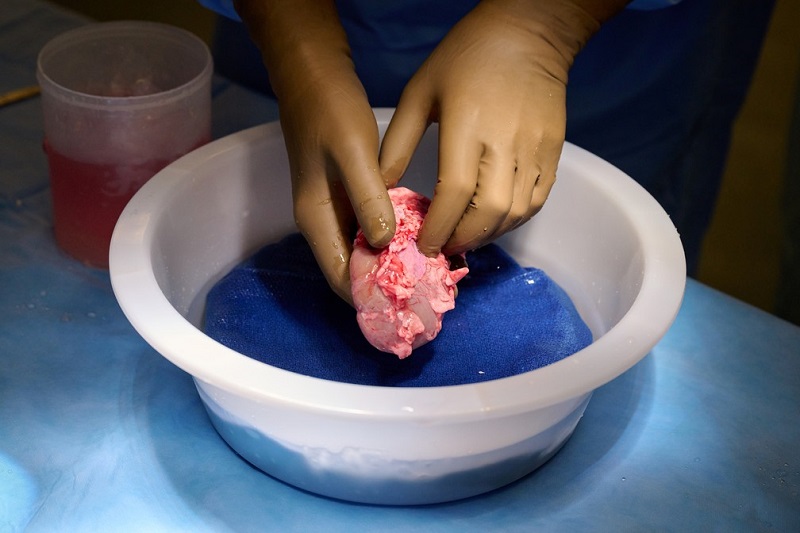 Cirurgiões dos EUA testam com sucesso transplante de rim de porco em humano