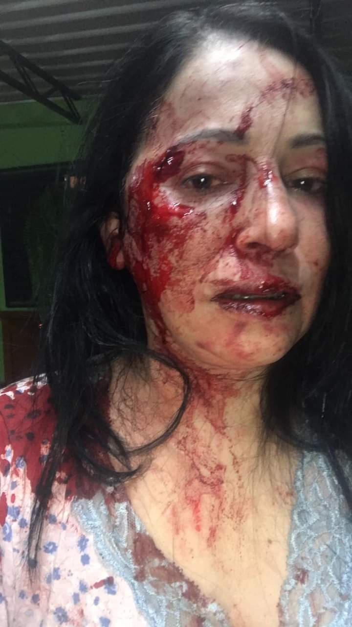 Moradora é barbaramente agredida por grupo de vizinhos em Palmital