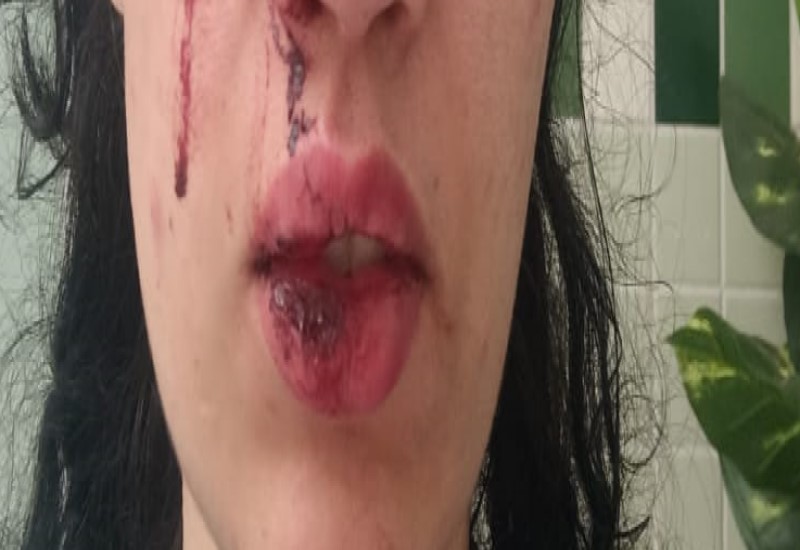 Mulher denuncia agressão de bombeiro militar e teme virar vítima de feminicídio em Assis