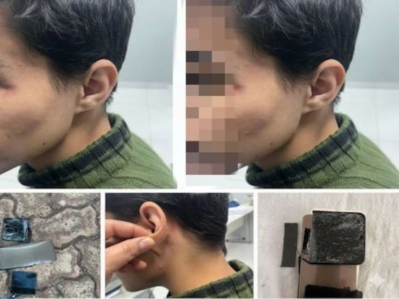 Funcionário público com histórico de agressões ataca estudante em Cândido Mota