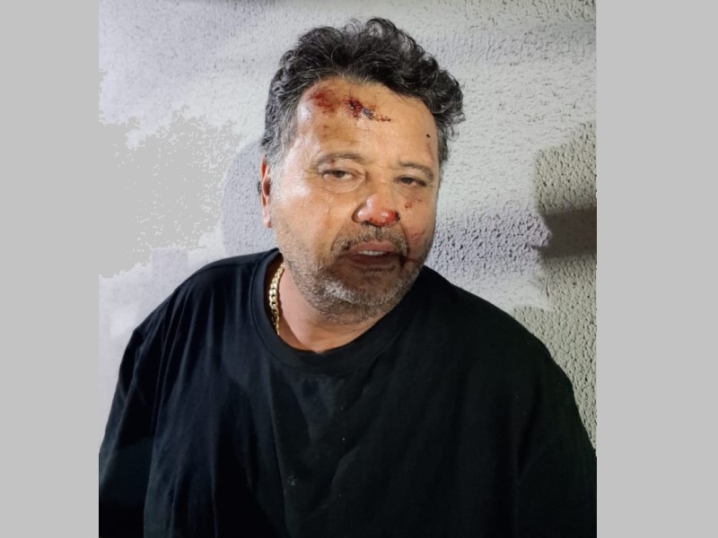 Um ano após ser agredido, advogado de Cândido Mota rompe o silêncio